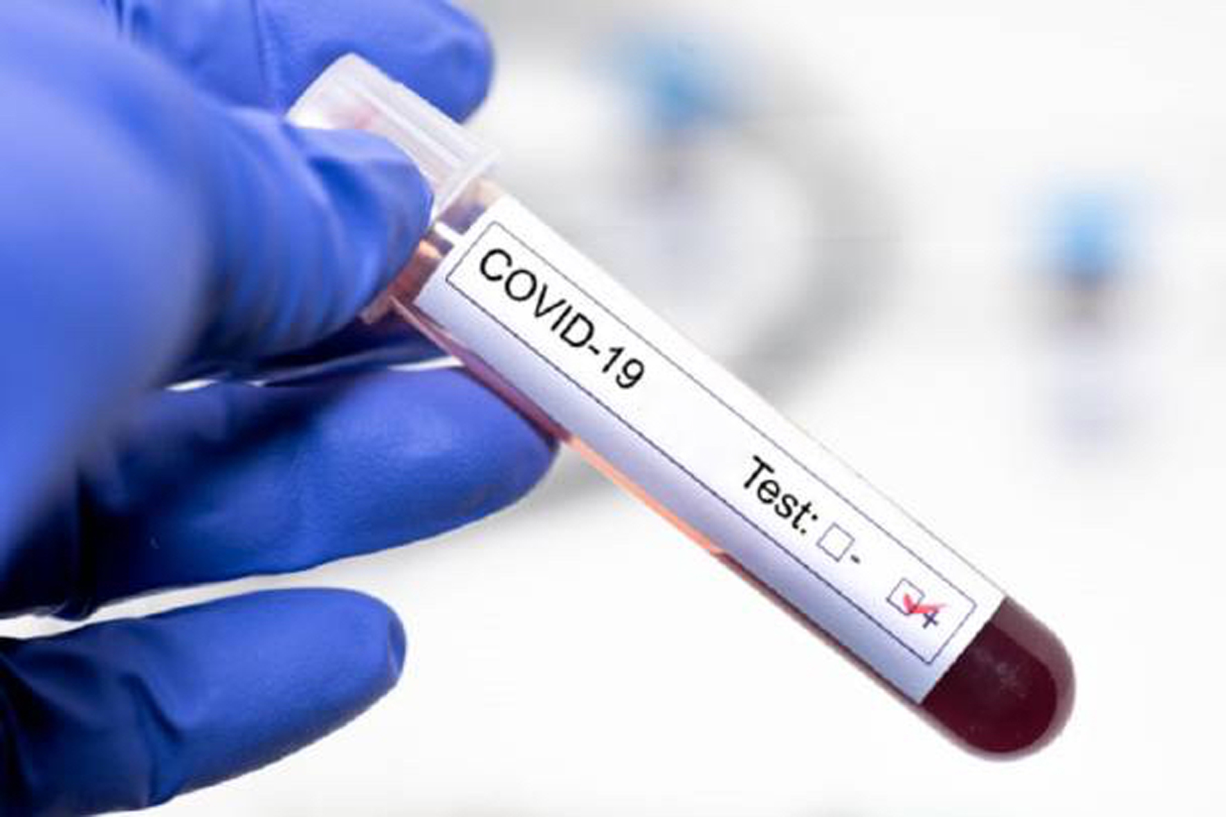 El Hierro suma tres nuevos contagios de COVID-19 en las últimas 24 horas